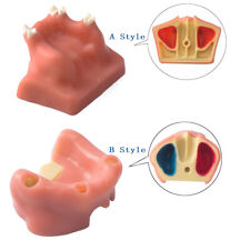 1pc Easyinsmile Dental Tooth Model Sinus Lift Practice Study Teach Model 2styles