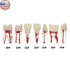 Us 7 Pcs Dental Root Canal Practice Model Teeth Pulp Study Rct Endo File 16 36