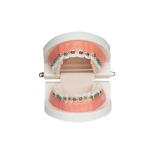 Dental Typodont Orthodontic Treatment Teeth Model Malocclusion Study W Bracket