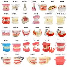 Multiple Types Dental Teaching Teeth Model Typodont Ortho Implant Practice Demo