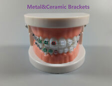 1pcs Dental Orthodontic Treatment Model With Ceramicmetal Brackets Study Model