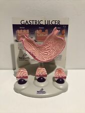 Vintage Nexium Stomach Gastric Ulcer Anatomical Model