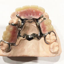Metal Partial Denture New Custom Impression Kit Upper Lower Dentures