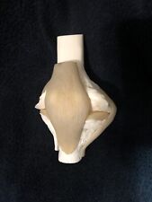 Vintage Life Size Osteoarthritis Functional Knee Joint Anatomical Model Hylan