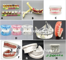 Dental Implant Model Teeth Caries Disease Teaching Analysis Study Demonstration