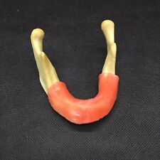 Mandible With Soft Tissue For Dental Implant Model Training Tool