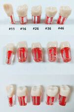 5pcs Dental Root Canal Teeth Study Practice Model For Endodontic Pulp File Molar