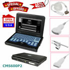 Portable Ultrasound Scanner Laptop Machine Ultrasonic Systems Cms600p2probe Usa
