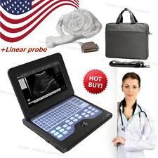New Portable Ultrasound Scanner Machine Medical Use7.5mhz Linear Probe Usbvga