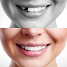 Temporary Tooth Repair Kit Temp Dental Repair Replace Missing Diy Make 12 Teeth