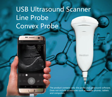 Usb Ultrasound Probe For Smartphonetabletcphandheld Ultrasound Diagnostic Sys