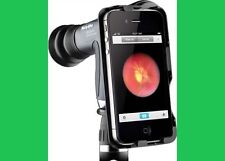 Welch Allyn Iexaminer Adopter For Panoptic Ophthalmoscope