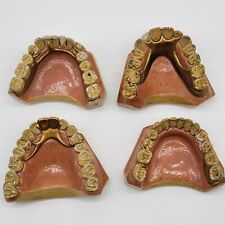 Vtg Dental Partial Bridge Denture Samples Oddities Medical Collectibles Dentist