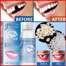 Tooth Repair Beads Granules Temporary Tooth Glue Reusable Moldable False Teeth