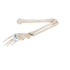 A45 Arm Skeleton - 3b Smart Anatomy