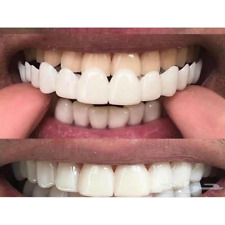 Smile Snap On Upperbottom Teeth Denture Veneers Set Eat False Dental Tooth Cover