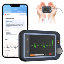 Ekg Heart Rate Monitor Bluetooth Handheld Ecg Recorder App Ai Analysis Report